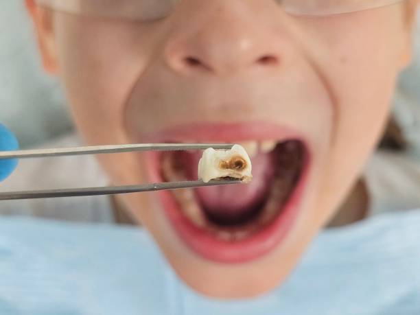 Best Urgent Dental Care for Toothaches in Dubach, LA